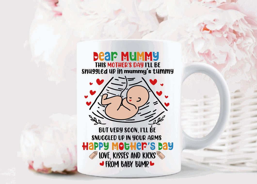 Ultrasound mug